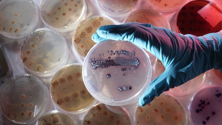 Mikrobielle Kulturen in Petrischalen, vorn: Streptomyces lividans
