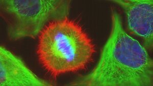 Fluoreszenzmikroskopische Aufnahme einer Zelle