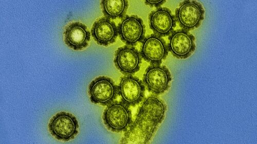 H1N1 Influenza-Virus.