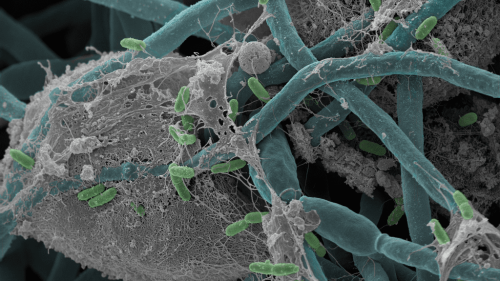 Eine Bakterien- und Pilzart zerstören gemeinsam Darmzellen.