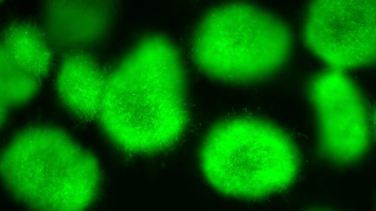 An Aspergillus nidulans reporter strain that produces green fluorescent protein (GFP).