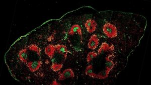 germinal center B-cell maturation