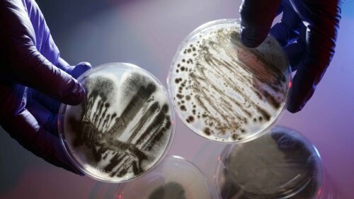 Der Schimmelpilz Aspergillus fumigatus gehört zu den Infektionserregern, die das Forschungsteam mit Hilfe nichtpathogener Mikroben bekämpfen will.