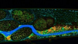 Part of the intestine of Caenorhabditis elegans under the microscope, enriched with malpinins.